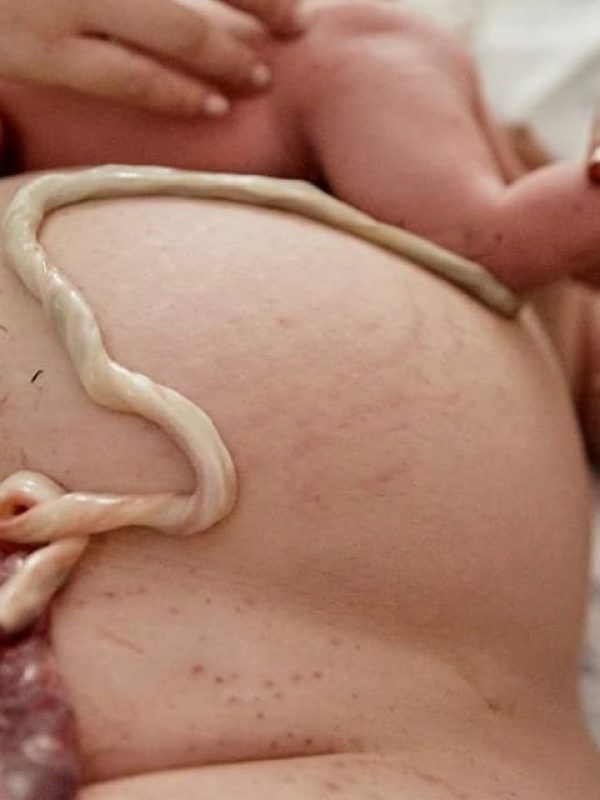 ESPECIALISTASPARTOYPLACENTA